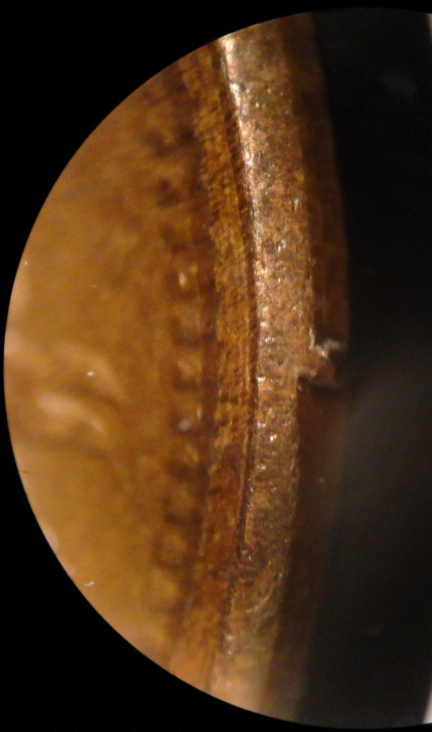 My-1866-IHC:-The-First-Broken-Collar-Attributed-Indian-Head